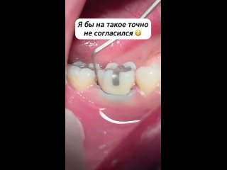 Какие черви?  Это нить прокладывается между зубом и десной при лечении у хорошего врача🤷♀️🙂 - Мария Нарыкова
