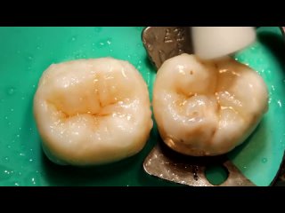 Video by Dental Hall (Дентал Холл) | Стоматология в Уфе
