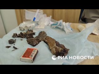 Заведующий хирургическим отделением мариупольской больницы Вадим Чайка показал РИА Новости внушительную коллекцию... (видео)