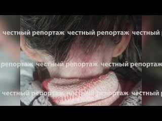 Уголовное дело об оказании услуг, не отвечающих требованиям безопасности, возбуждено за насилие в отношении пожилых... (видео)