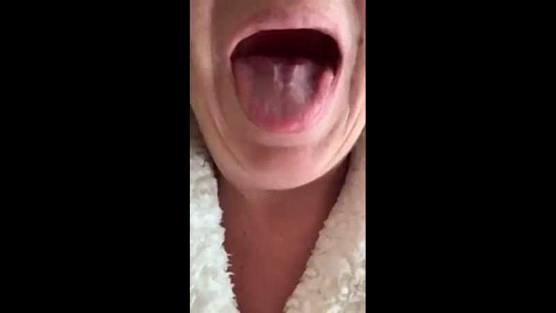 210107 Tongue spasms after Moderna