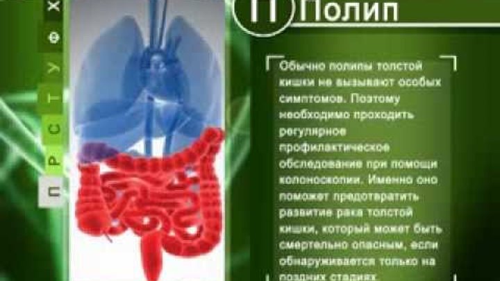 Классификация патологии тела матки. Психосоматика болезней гастрит. Психосоматика болезней желудок гастрит язва. Лекарство от полипов в матке. Психосоматика болезни язва желудка.