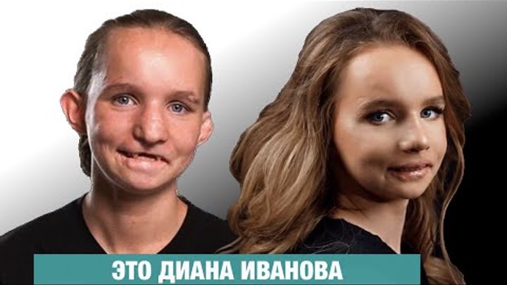 Самые странные пластические операции участников шоу "Дом-2" Дом 2 Жара Дзен