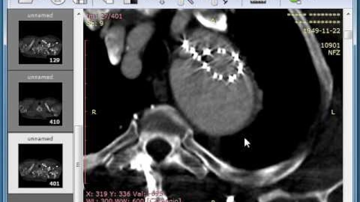 Radiant dicom viewer. Dicom viewer. Dicom мрт программа для просмотра. Радиант dicom. Dicom программа.