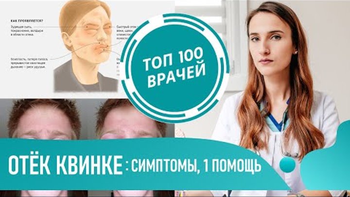 Как выглядит отек квинке на глазах PPT Associazione LAM Italia Profilo Associazione PowerPoint Presentation ID: