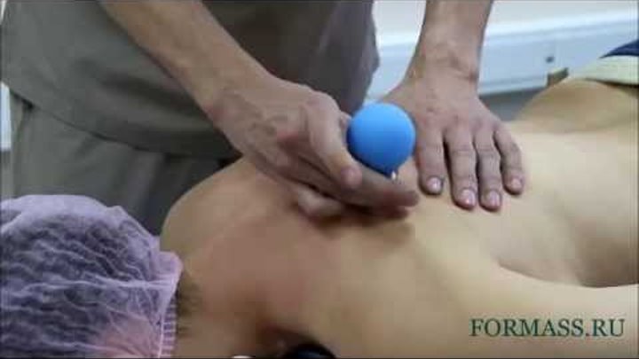 Массаж разбить холку. Массаж разбить холку. Вдовий горб после массажа. Массаж разбить холку. Массаж воротниковой зоны до и после.