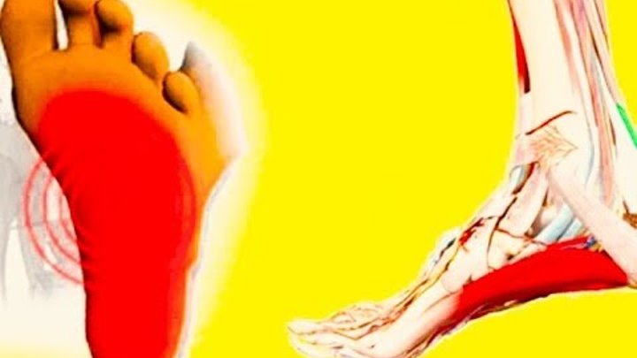 Лазерная эпиляция пальцев ног. Судороги в пальцах ног. Судороги в пальцах ног. Судорога большого пальца ноги. Самомассаж ступней.