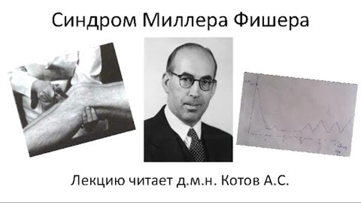 синдром миллера