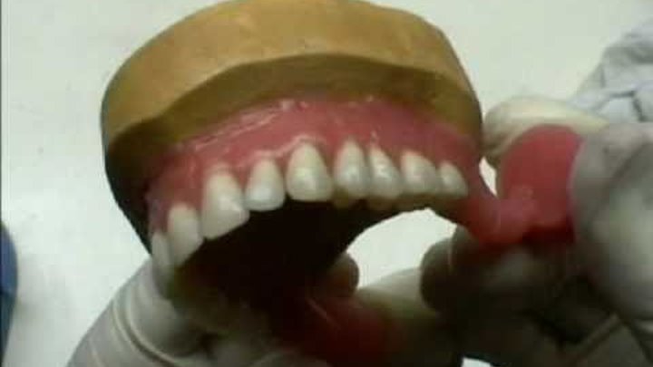 Пластмасса для базисов протезов. Моделировка базиса протеза. Моделировка базиса верхней челюсти. Окончательная моделировка базиса. Моделировка базиса нижней челюсти.