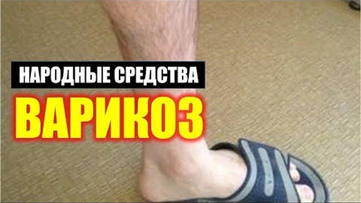 Как снять зуд ног в домашних условиях