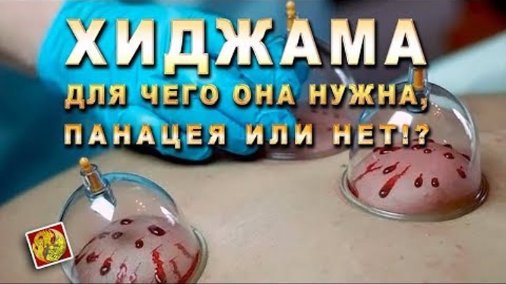 Хиджама лица до и после отзывы