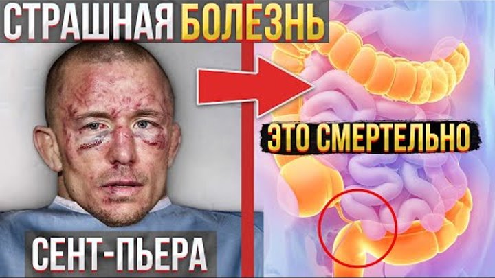 Жорж сен Пьер в кино