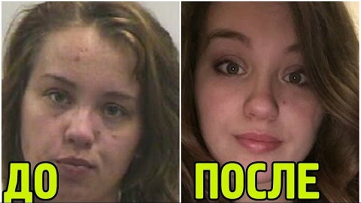 Как выглядит кожа курильщика Люди Бросившие пить: фото ДО и ПОСЛЕ