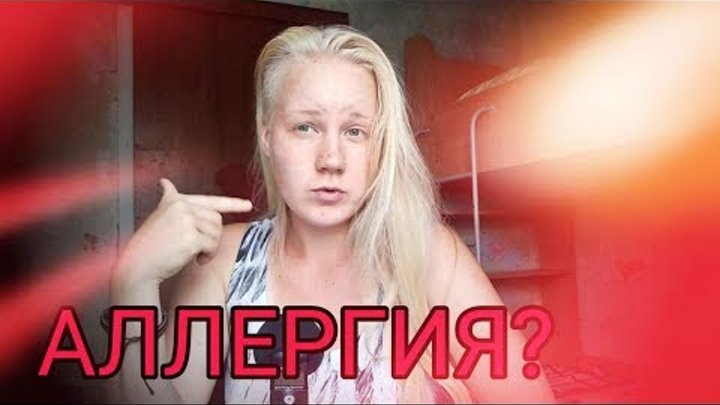 Как снять аллергическую реакцию без таблеток
