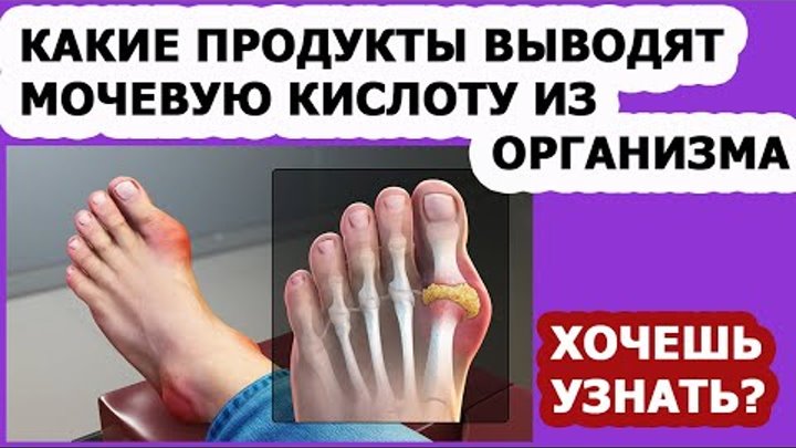 Продукты с высоким содержанием мочевой кислоты таблица. Таблица содержания пуринов и мочевой кислоты в продуктах. Продукты в которых мочевая кислота. Пурины в продуктах питания таблица подагра и мочевая кислота. Содержание пуринов в продуктах.