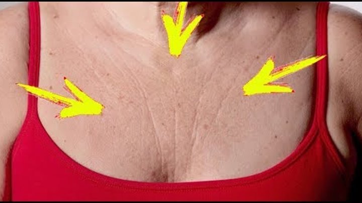 Тейпирование от колец венеры на шее схема