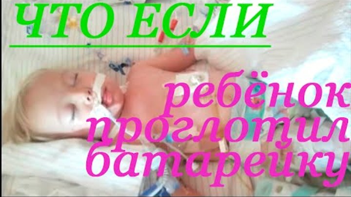 Что делать если ребенок проглотил. Может ли ребенок проглотить мизинчиковую батарейку. Если ребёнок проглотил батарейку. Ребенок проглотил батарейку. Ребёнок проглотил батарейку таблетку.