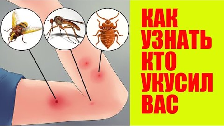 Как выглядят укусы на коже