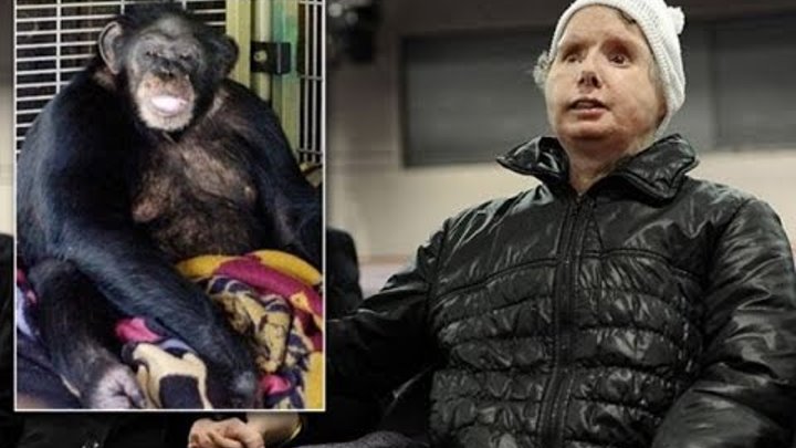 шимпанзе отгрызла лицо женщине