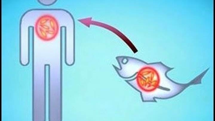 Описторхозом заражаются через. Описторхоз кошачья двуустка. Метацеркарии описторхоза. Рыба зараженная описторхозом. Профилактика при описторхозе.