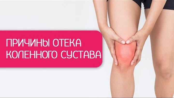 Как быстро снять отек сустава