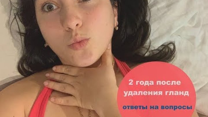 Как выглядят миндалины после операции Жизнь без гланд // Спустя 2 года // Ответы на вопросы // Удаление гланд (миндали