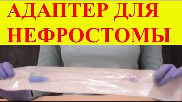 Переходник адаптер для нефростомы