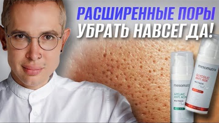 РАСШИРЕННЫЕ ПОРЫ Как избавиться в домашних условиях? САМЫЙ ДЕЙСТВЕНН ...