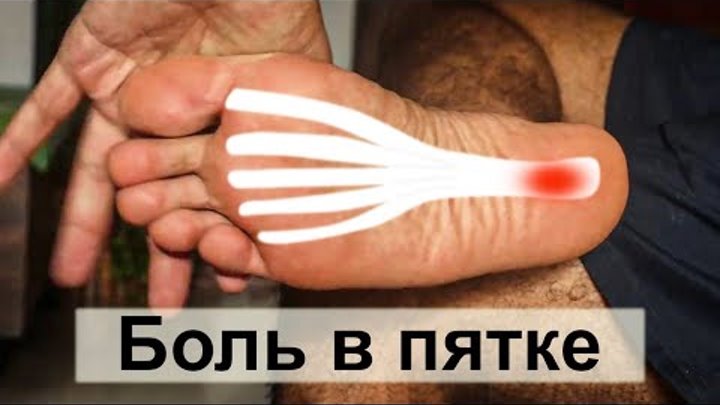 Как быстро снять боль в пятке Как быстро снять боль в пятке