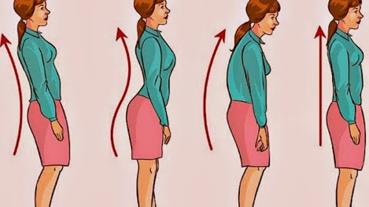 Анатомические правильная походка. Правильная и неправильная осанка. Исправление походки у подростка. Красивая походка и осанка. Осанка.