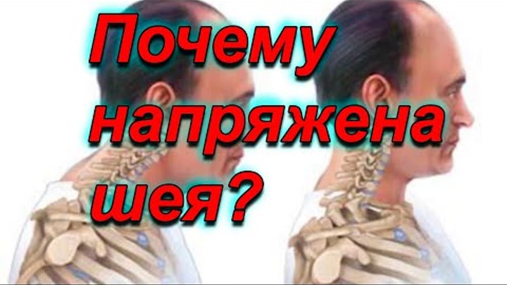 Причины боли в шее, головной боли. Как снять спазм мышц шеи? - YouTube