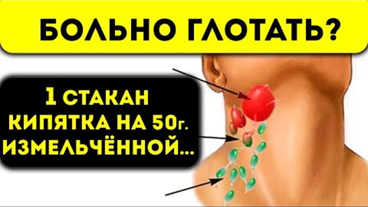Как лечить воспаление лимфатических узлов