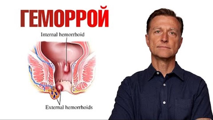Лечение наружного, внутреннего и комбинированного геморроя у мужчин и женщин люб