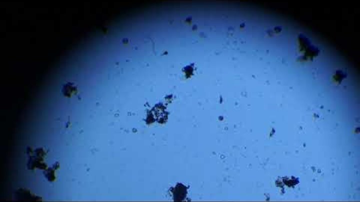 Коловратки. Крупные микроорганизмы из озера Муровое