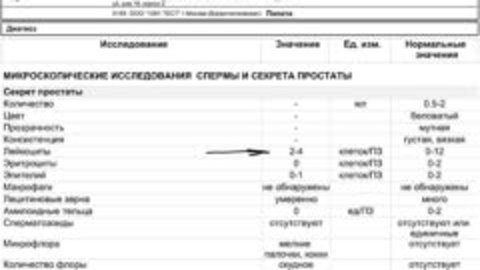 Сок предстательной железы. Лецитиновые зерна в секрете простаты микроскопия. Простатический сок микроскопия. Микроскопическое исследование сока простаты УГМК. Исследование секрета предстательной железы.