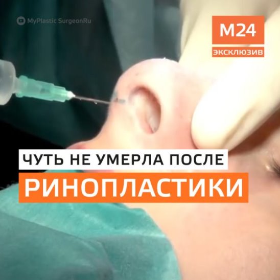 Девушка в Москве чуть не умерла после ринопластики