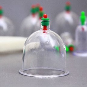 Фотография от Life care hijama FAISALABAD