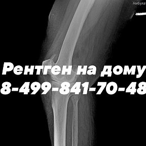 Фотография от Рентген на дому 8-499-841-70-48