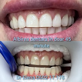 Фотография от Clinica Favorit Dental 076062855
