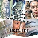 Удаление ТАТУажа Астрахань