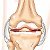 Как вылечиться от артроза и артрита