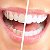 Косметическое отбеливание зубов - Elit.smile-Чита