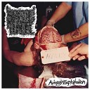 Spastic Tumor - Brutally Dismembered Alive in an Infernal Septic Tank of Boiling Liquified Putrid Genital Remains Doused in Nauseating…