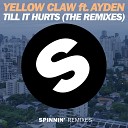 Yellow Claw ft Ayden - Till It Hurts LNY TNZ Remix