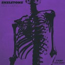 Tr3vV feat OTDee - Skeletons