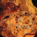Blasted Pancreas - I Am Sick of You All