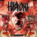 HYGROMA - Escape of Bodily Fluids from Neorectal Scabs