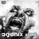 Assuc - Agonix X6cta Remix