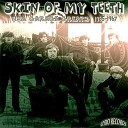 The Sherlocks - skin of my teeth Dot