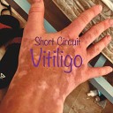 Short Circuit - Vitiligo